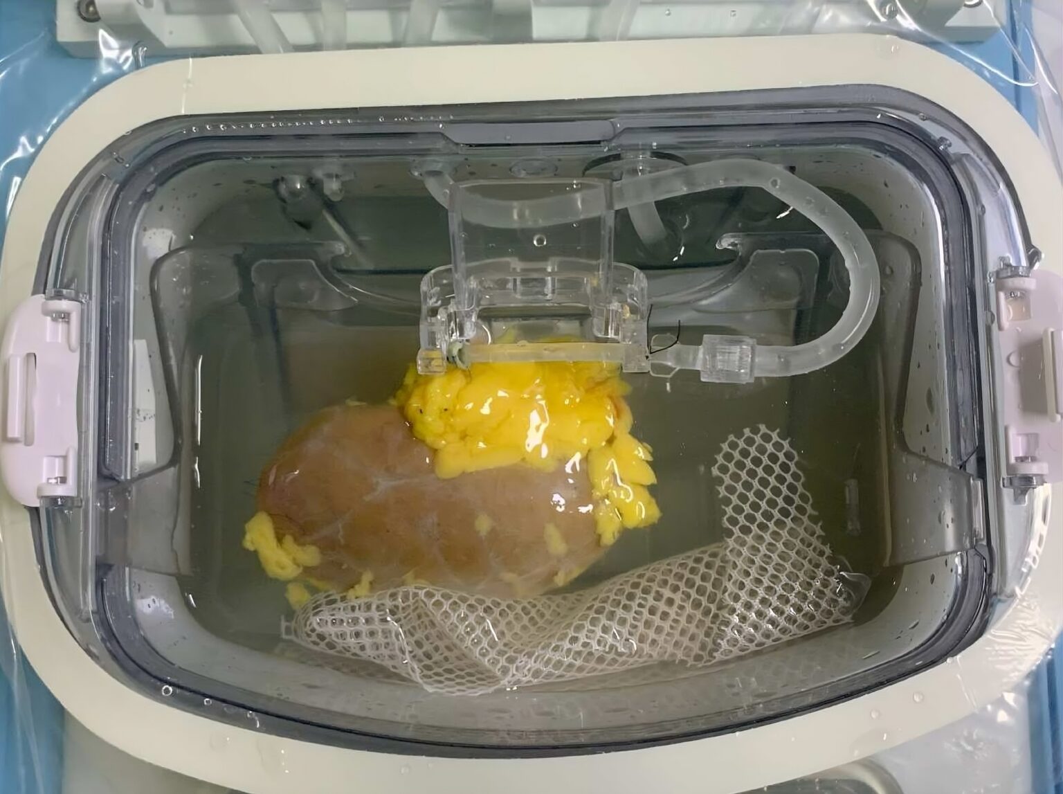 The kidney pre-transplant in a perfusion device which is used to circulate a solution that contains the converting enzymes (Nature Biomedical Engineering).
