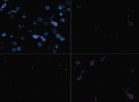 Microscopic view of Carina Fota's research