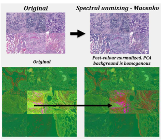 Colour Normalization of Hyperspectral Scanned H&E Stained Tissue