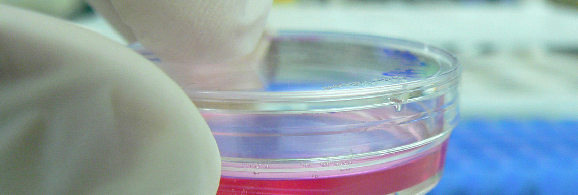 A close up of a petri dish